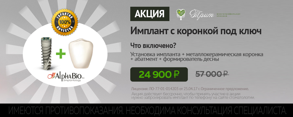 Имплант зуба цена москва под ключ с коронкой отзывы